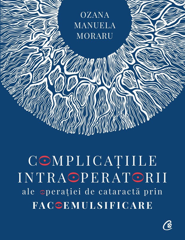 Complicațiile intraoperatorii ale operatiei de cataractă prin facoemulsificare